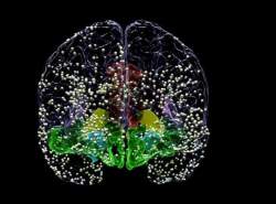 درمان افسردگی با شبیه سازی جریان های الکتریکی مغز