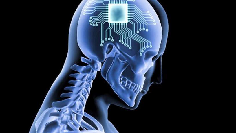 کاشت تراشه‌های کامپیوتری در مغز انسان‌