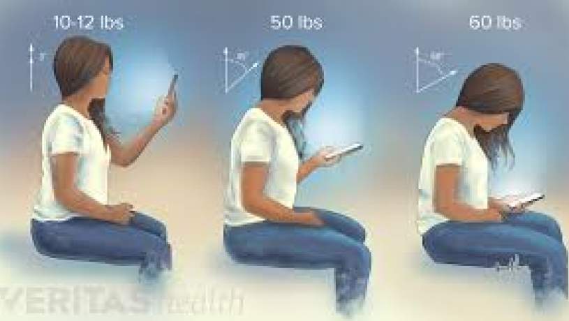 موبایل باعث «سندرم گردن پیامکی» می‌شود