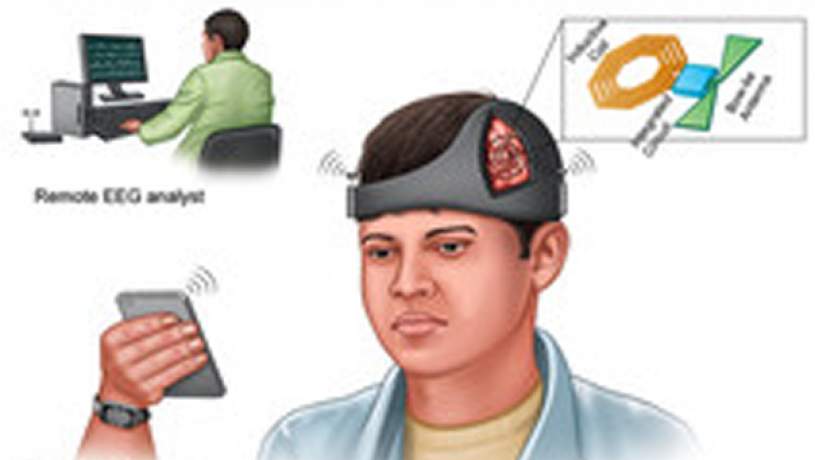 کلاه هوشمند از تشنج مغزی
 بعد از جراحی جلوگیری می‌کند