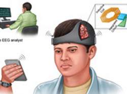 کلاه هوشمند از تشنج مغزی
 بعد از جراحی جلوگیری می‌کند