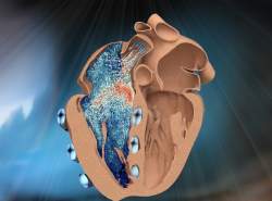نمونه روباتیک بطن راست قلب طراحی شد